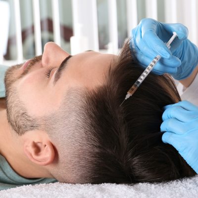 Vlasová mezoterapia Vlasová mezoterapia